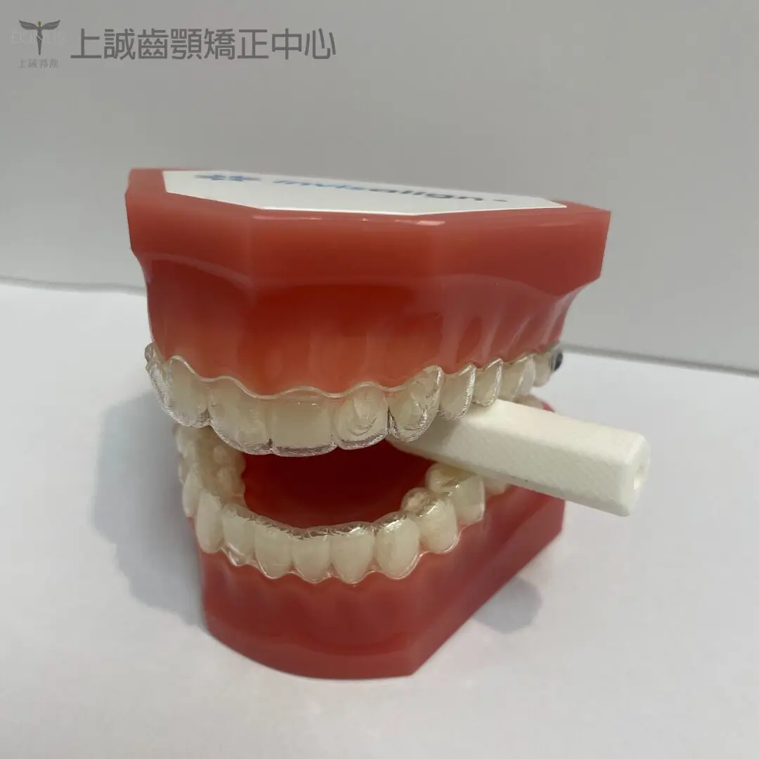 隱適美QQ是什麼? 3 短小柱型