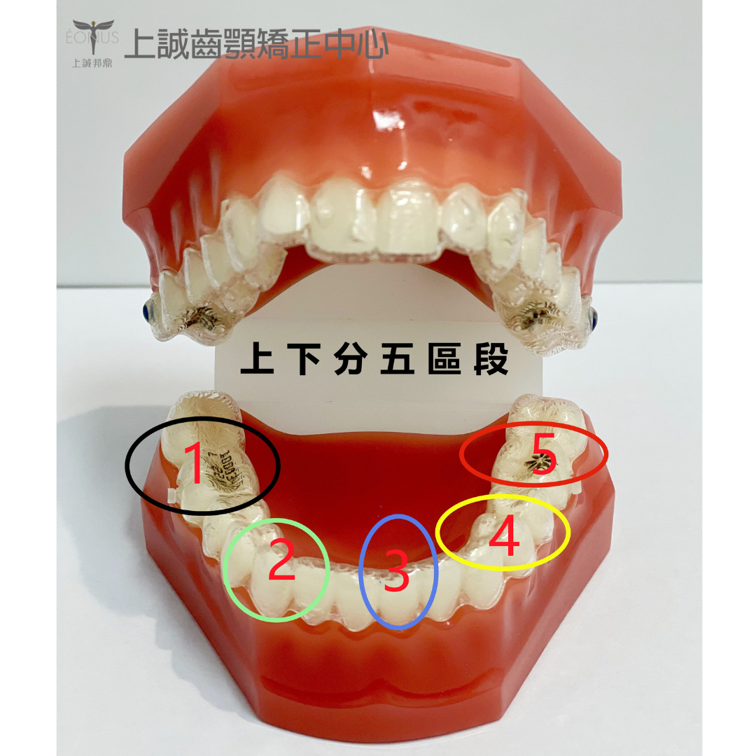 隱適美QQ是什麼? 5 短小柱型(圓形或六角形)