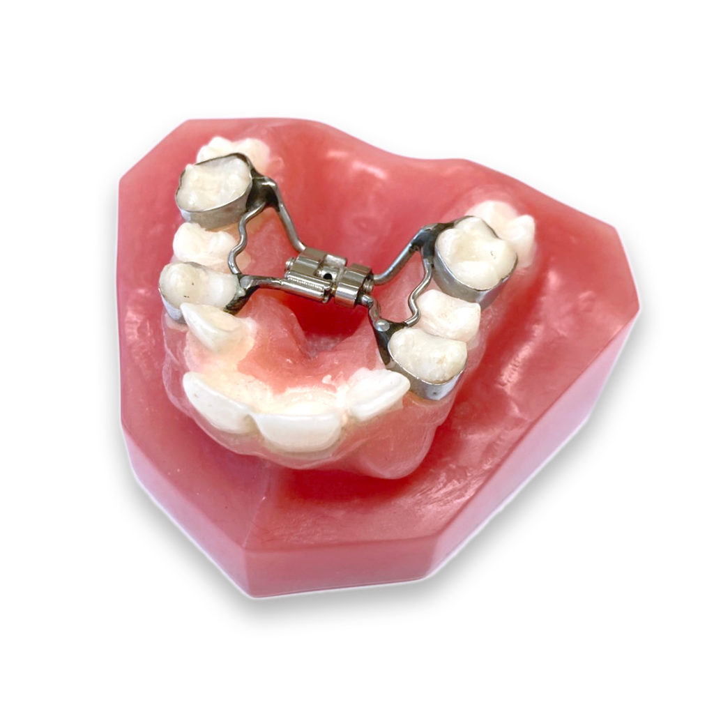 牙弓擴張器照片