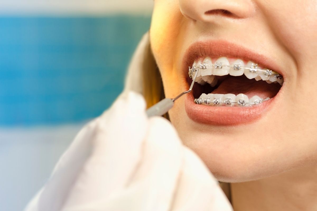 矯正知識 1 hidden-challenges-of-orthodontics